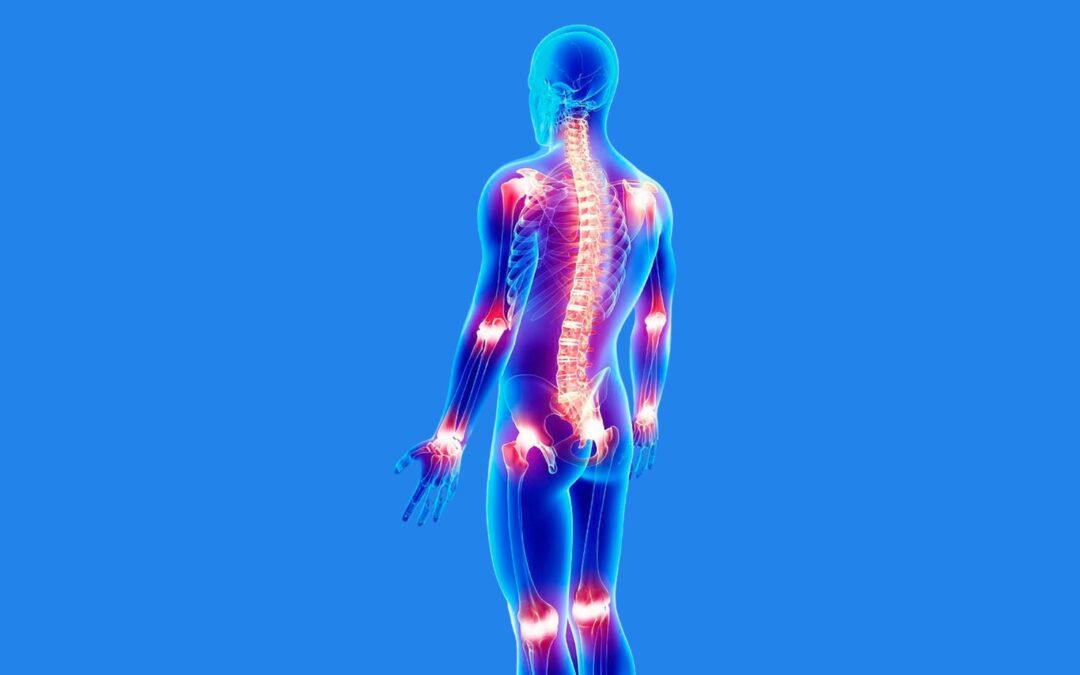 Pain Study in Osteogenesis Imperfecta
