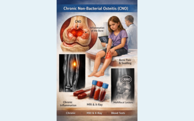 New Module Launch: Chronic Non-bacterial Osteitis (CNO)